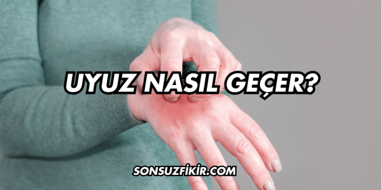 Uyuz Nasıl Geçer?