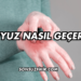 Uyuz Nasıl Geçer?